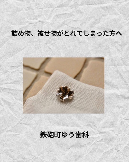 詰め物、被せ物が取れてしまった方へ